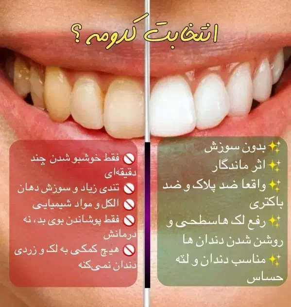 برای همیشه از بوی بد دهان راحت شو|آرایشی، بهداشتی، درمانی|قوچان, |دیوار