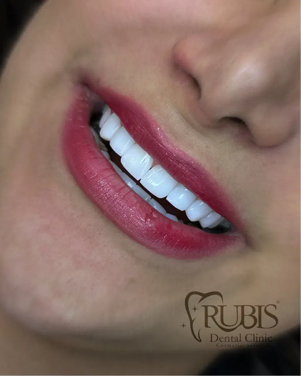 کامپوزیت ارزان|پزشکی|تهران, شهرک خرازی|دیوار