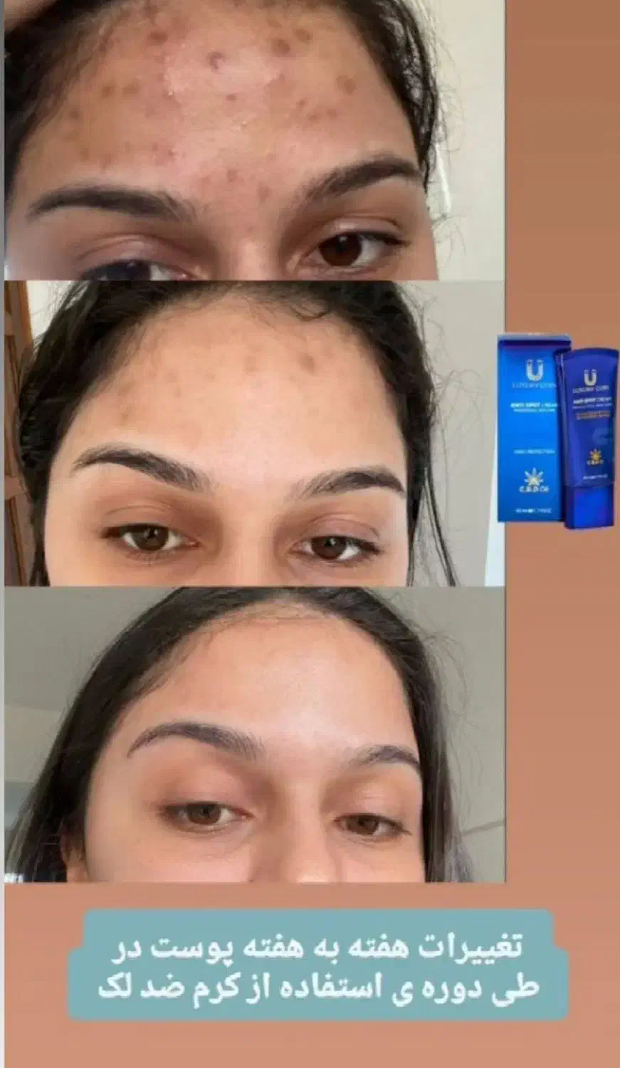 زیبایی صورت|آرایشی، بهداشتی، درمانی|خاش, |دیوار