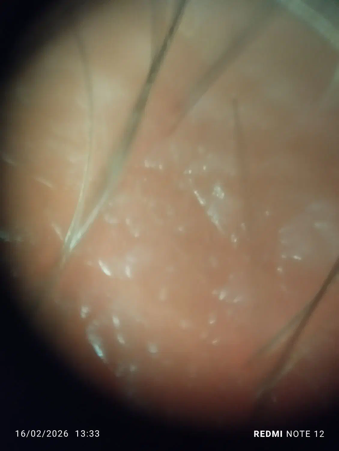 موی اسکوپ|لوازم جانبی موبایل و تبلت|مشهد, احمدآباد|دیوار