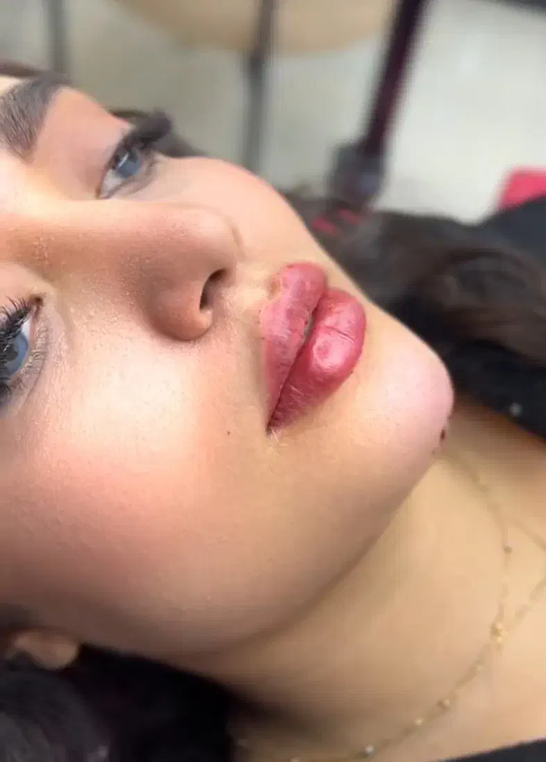 فقط امروز تزریق ژل با تخفیف عالی|خدمات آرایشگری و زیبایی|آبیک, |دیوار