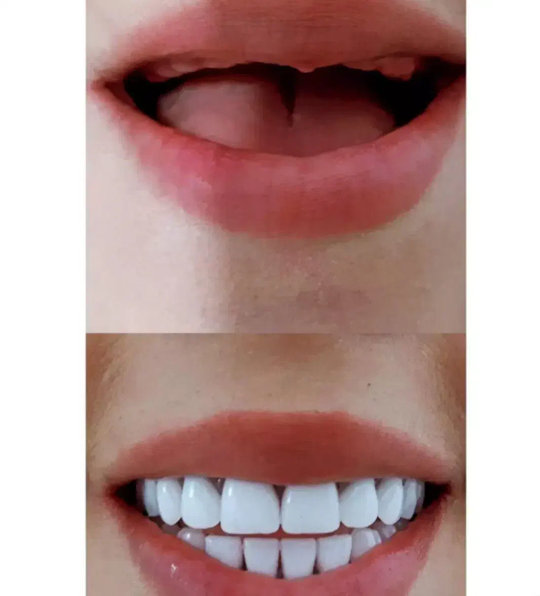 دندانسازی ایده آل|خدمات آرایشگری و زیبایی|لاهیجان, گلستان|دیوار