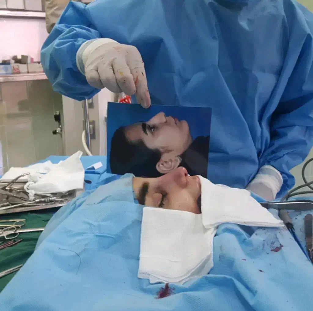 عمل بینی فقط با 50میلیون|خدمات آرایشگری و زیبایی|شیراز, قصرالدشت|دیوار