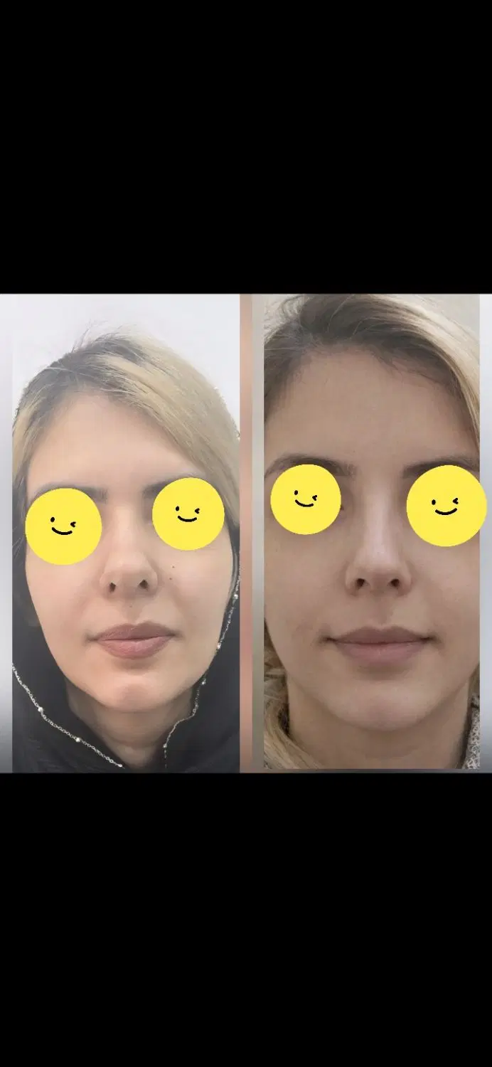 مطب|خدمات آرایشگری و زیبایی|گنبد کاووس, |دیوار