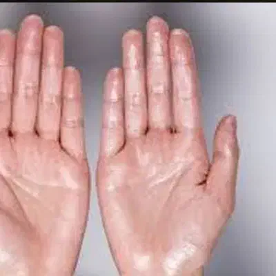 راهنمایی می خواهم برای  درمان عرق کف دست وپا|فعالیت داوطلبانه تحقیقاتی|اردبیل, |دیوار