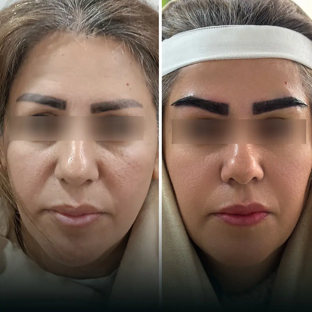 کلینیک VIP و تخصصی پوست،مو، زیبایی و لیزر پارسامهر|خدمات زیبایی و سلامت|تهران, حر|دیوار