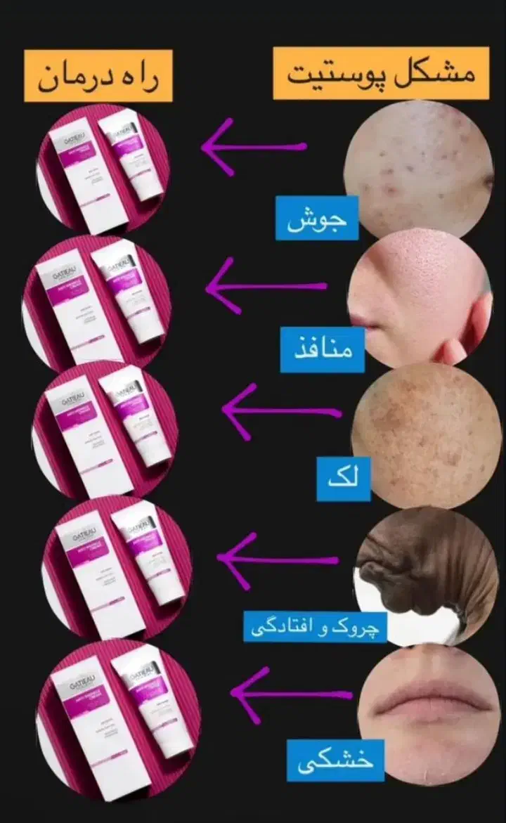 نمایندگی کرم بوتاکس گاتیو(ضدچروک 5کاره|آرایشی، بهداشتی، درمانی|صدرا-فارس, فاز ۲|دیوار