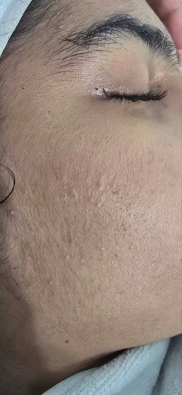 فیشیال و پاکسازی تخصصی پوست با کلی تخفیف|خدمات آرایشگری و زیبایی|خرمشهر, |دیوار