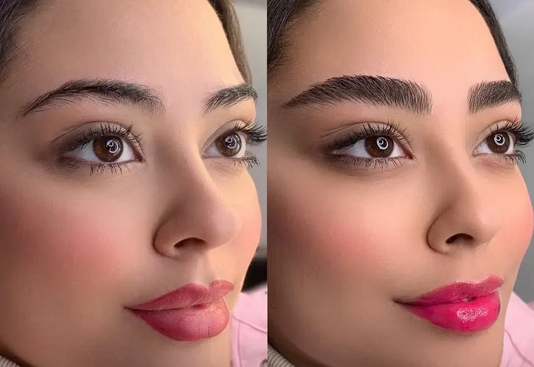 فرصتی تکرار نشدنی برای انجام میکروبلیدینگ|خدمات آرایشگری و زیبایی|تهران, دریا|دیوار