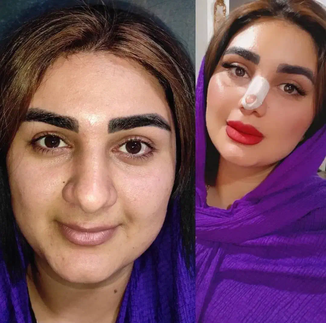 متخصص جراح زیبایی گوش وحلق وبینی|خدمات آرایشگری و زیبایی|قائمشهر, |دیوار