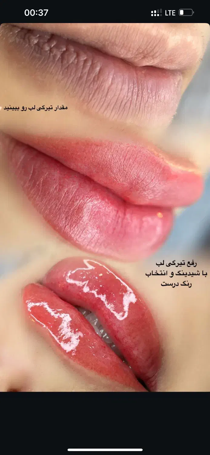 مدل رایگان فیبروزابروکرکی موی و درمان لب کبود|خدمات آرایشگری و زیبایی|قرچک, شهرک طلائیه|دیوار