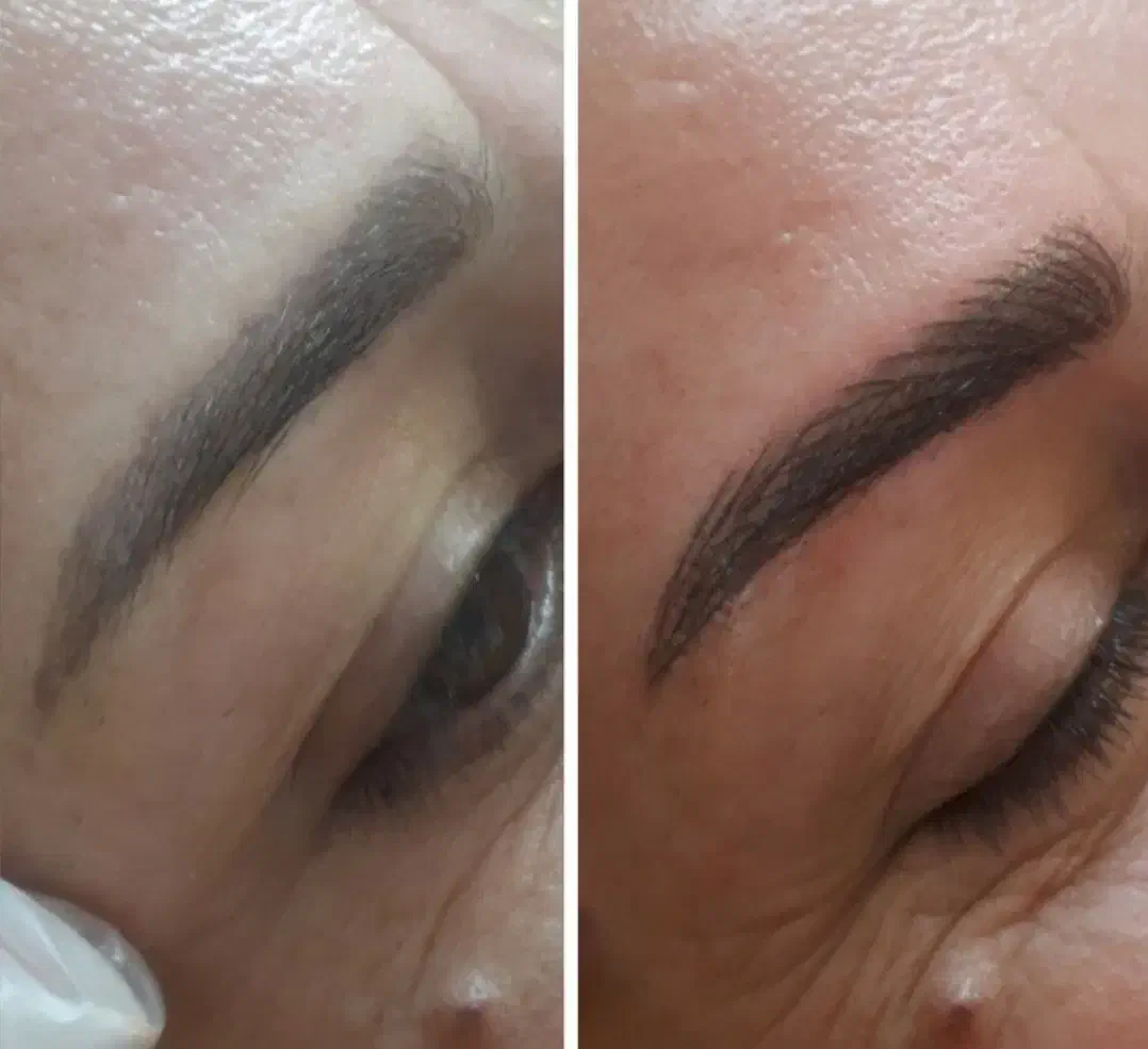 مدل برای فیبروز و خاویار تراپی|خدمات آرایشگری و زیبایی|اردبیل, |دیوار