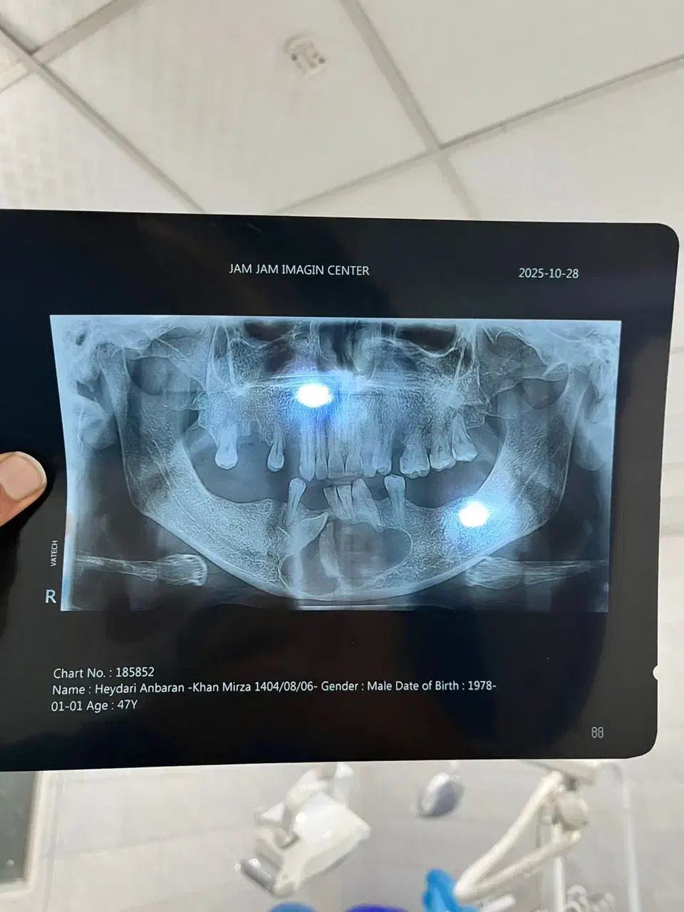 دستیار دندانپزشک درمانگاه|استخدام درمانی، زیبایی، بهداشتی|قدس, شهرقدس|دیوار