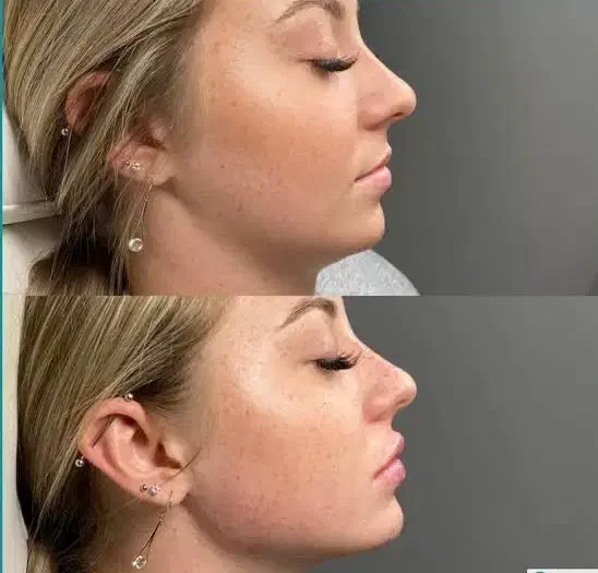 ژل و بوتاکس|خدمات آرایشگری و زیبایی|تهران, صادقیه|دیوار