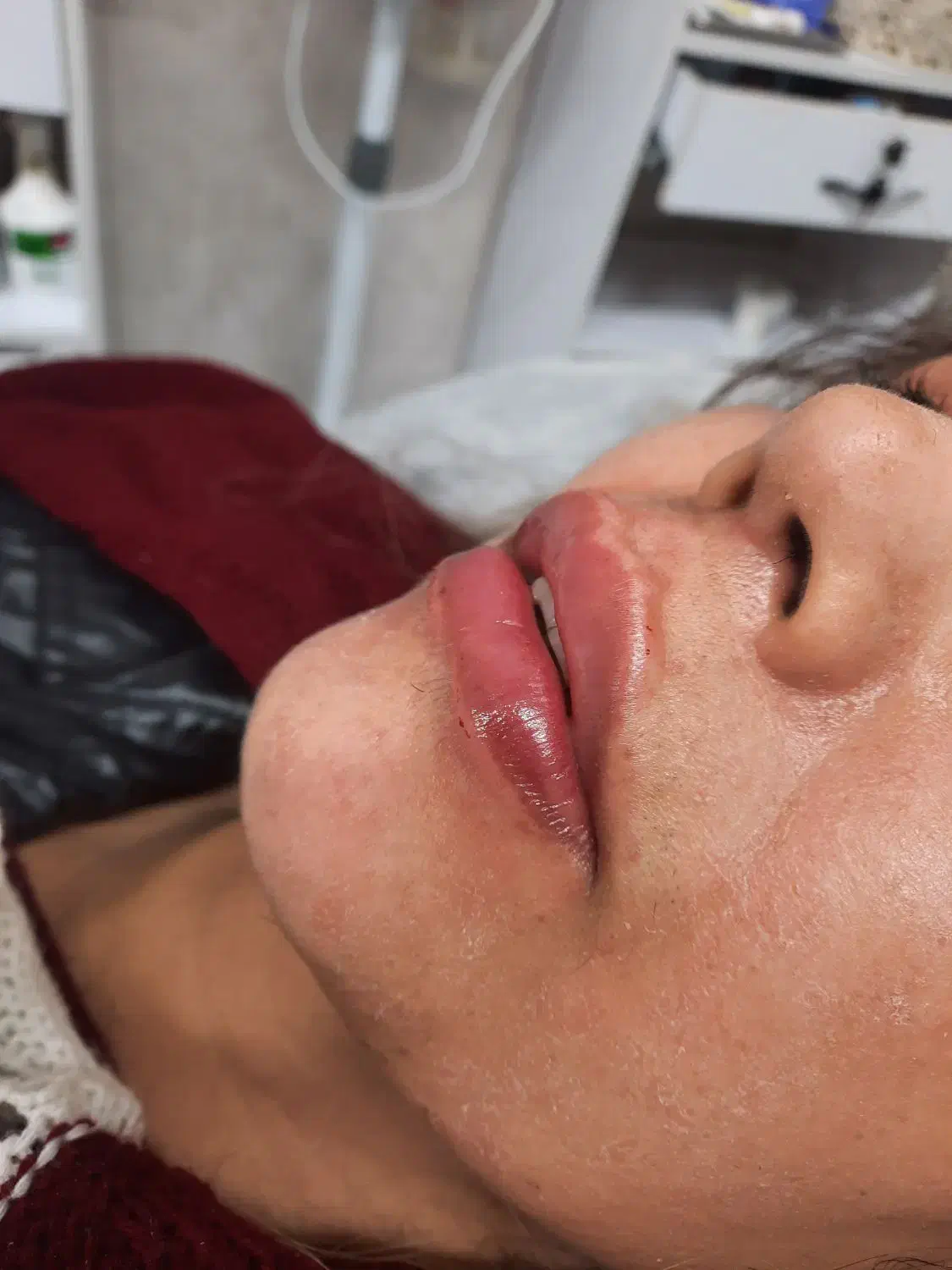 جشنواره ژل و بوتاکس و مزوتراپی لک وجوانسازی بانوان|خدمات آرایشگری و زیبایی|اصفهان, عسگریه|دیوار