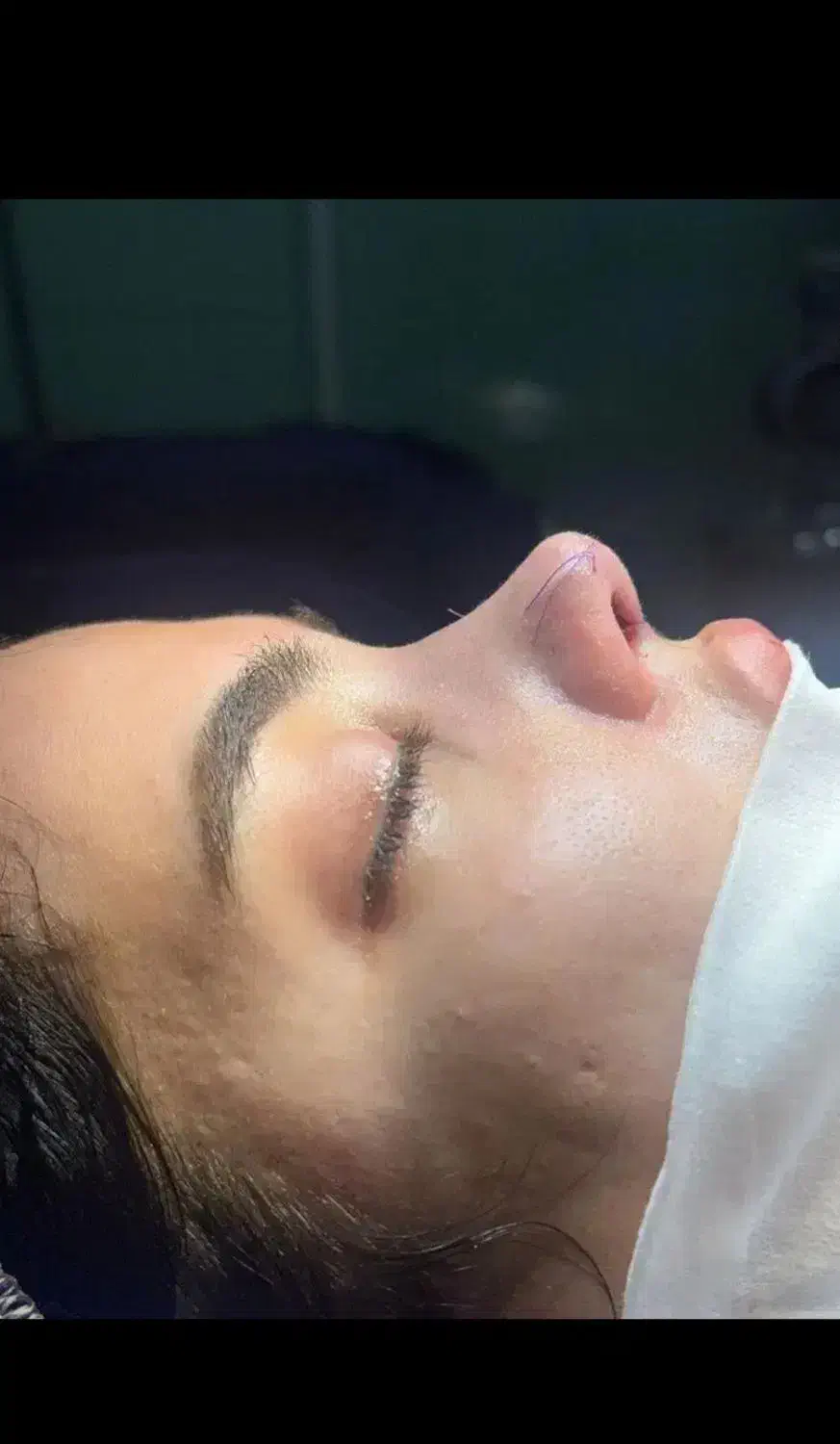 جشنواره عمل بینی|خدمات آرایشگری و زیبایی|ری, علایین|دیوار