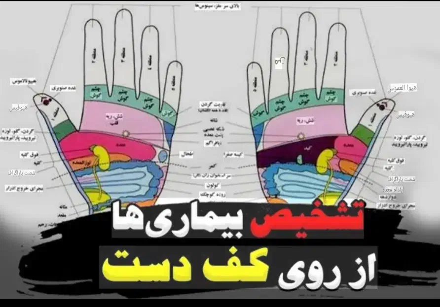 تشخیص بیماری ها از کف دست|فعالیت داوطلبانه|مشهد, شهرک رازی (شهرک غرب)|دیوار