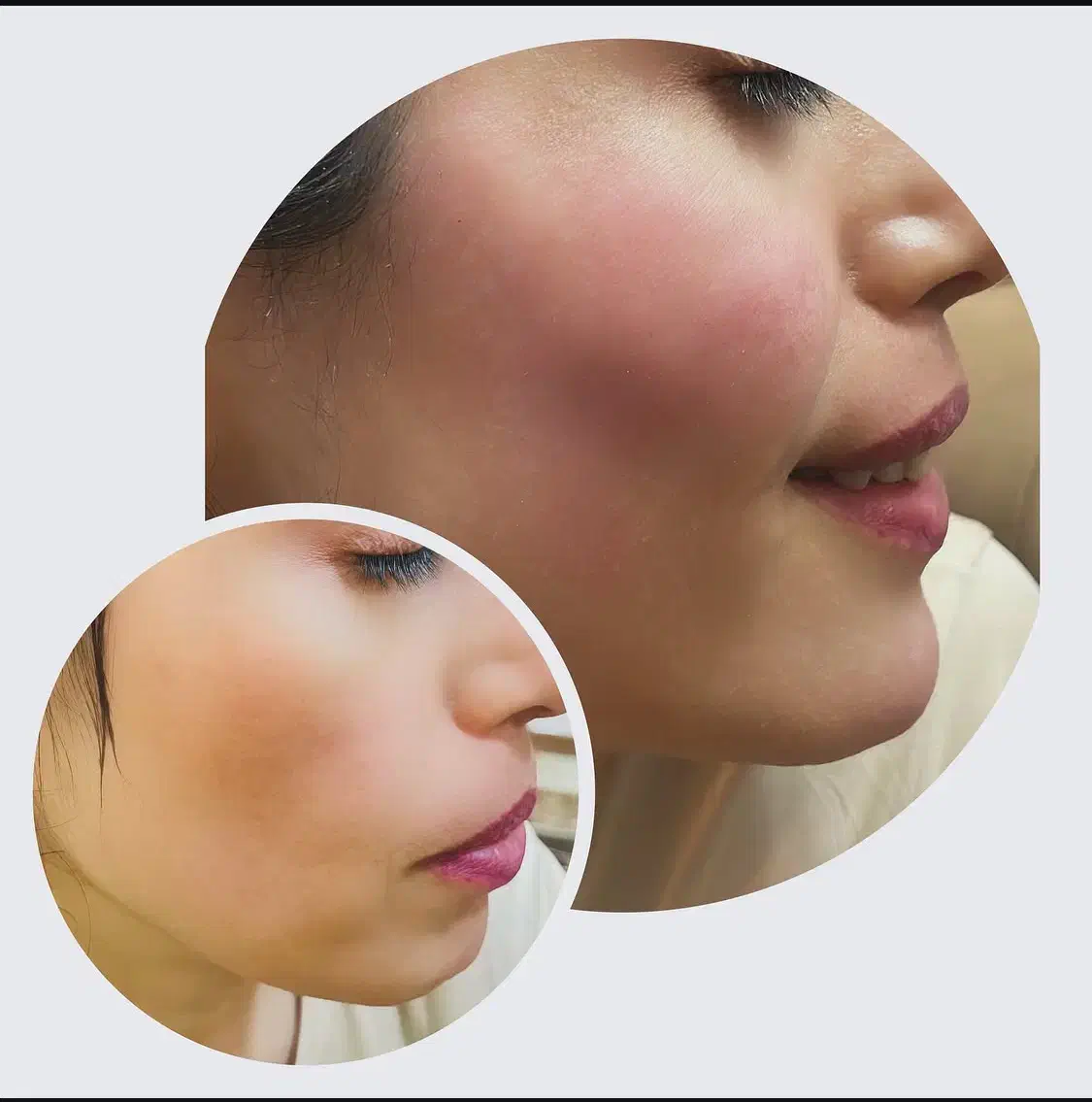 ژل،بوتاکس،پی آرپی،میکرونیدلینگ|خدمات آرایشگری و زیبایی|اصفهان, خانه اصفهان|دیوار