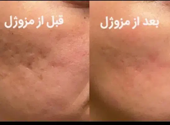 خدمات زیبایی|خدمات آرایشگری و زیبایی|ایذه, |دیوار