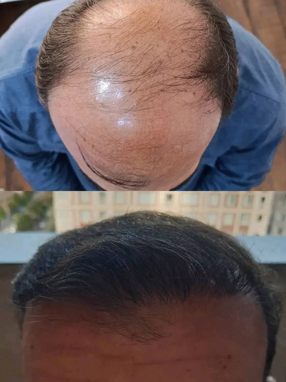 آموزش و جذب دستیار کاشت مو|خدمات آموزشی|تهران, محمودیه|دیوار