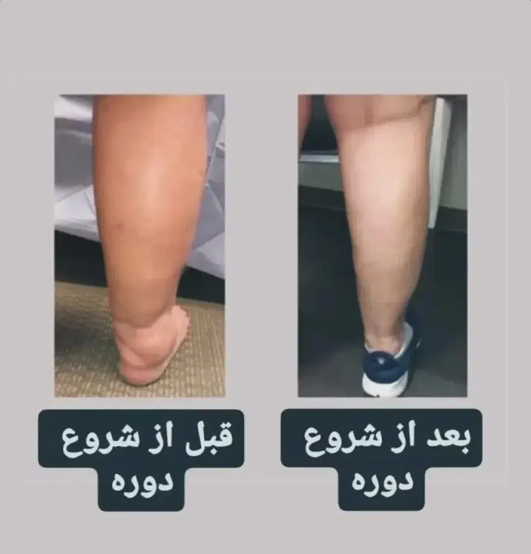 درمانگر بیماری روماتیسم و درد مفاصل|خدمات آرایشگری و زیبایی|اصفهان, شهرک سلامت|دیوار