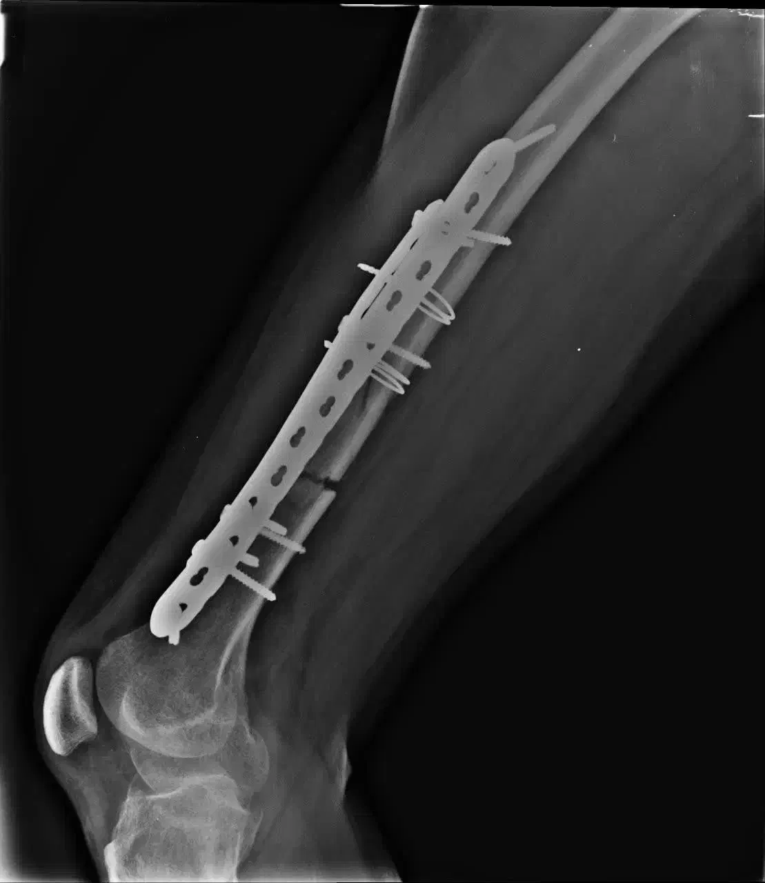 رادیولوژی در منزل|خدمات آرایشگری و زیبایی|قم, سالاریه|دیوار