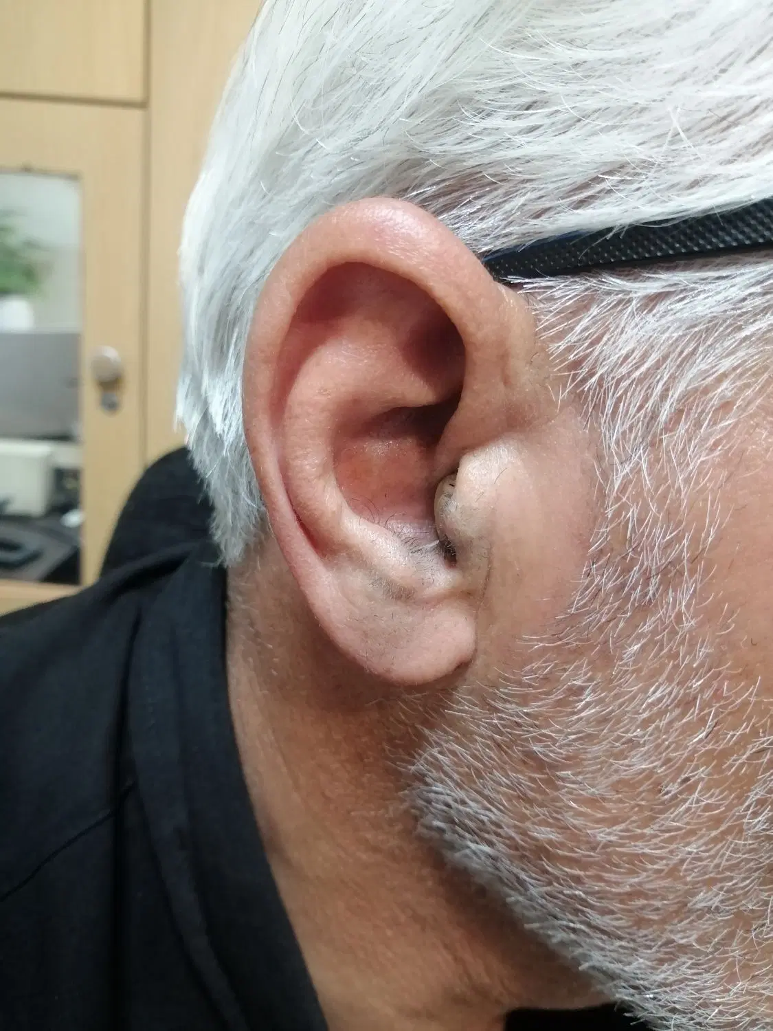 کلینیک تخصصی شنوایی و سمعک نرخ دولتی(اقساطی)|آرایشی، بهداشتی، درمانی|تهران, افسریه جنوبی|دیوار