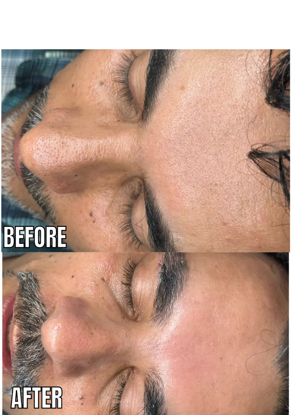 مدل پاکسازی صورت و بدن(خانم و اقا)باهم یا جدا|خدمات آرایشگری و زیبایی|مشهد, کوثر|دیوار