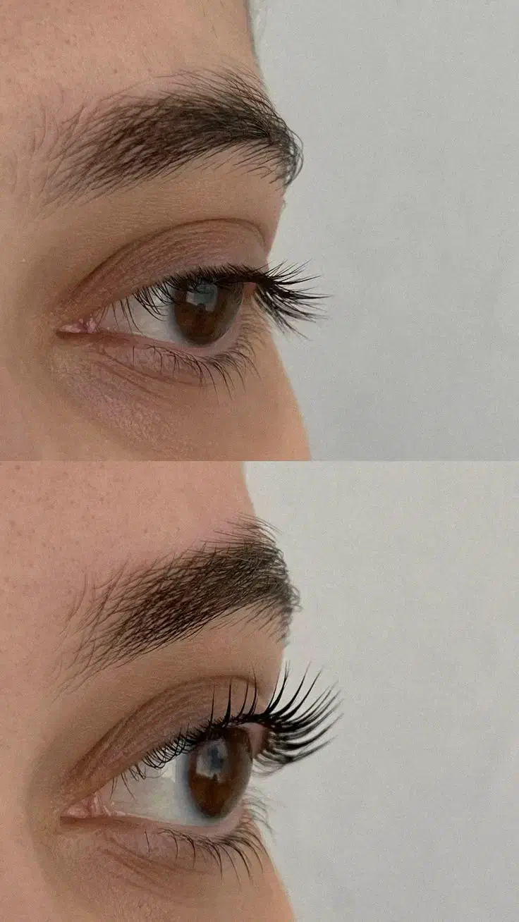 آموزش لیفت فقط با ۲۸۰۰|خدمات آموزشی|بندرعباس, |دیوار