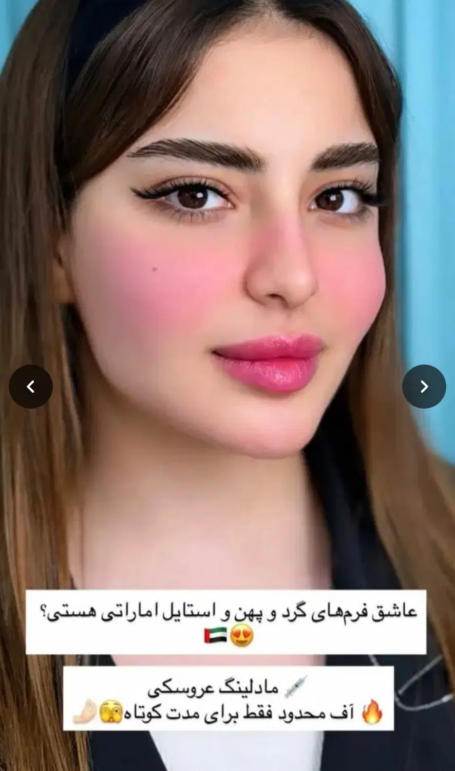 ژل،بوتاکس،فیلربادی باسن بیکینی،پی ارپی زاویه سازی|خدمات زیبایی و سلامت|تبریز, |دیوار
