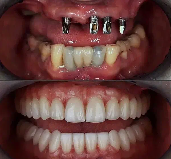 دندانپزشکی  تخصصی ترین مرکز ایمپلنت و جراحی|خدمات آرایشگری و زیبایی|ورزقان, |دیوار