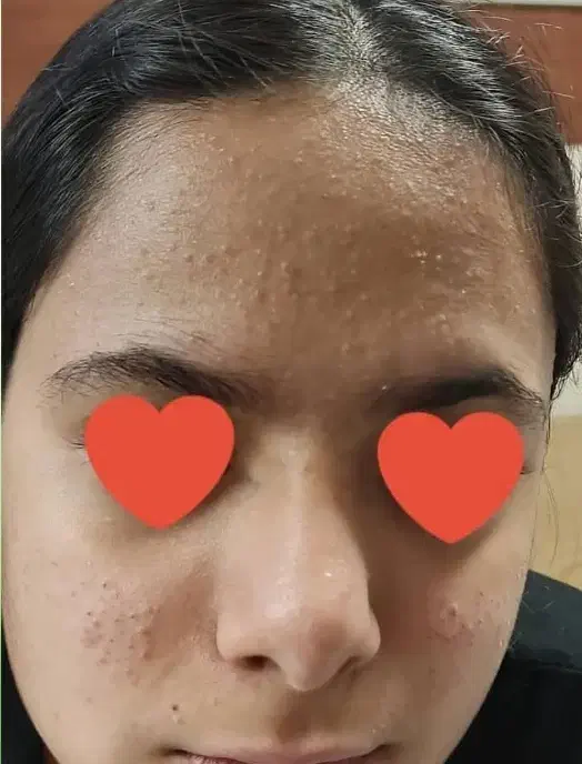 ورکشاپ تخصصی پوست (پاکسازی)|خدمات آموزشی|سیرجان, |دیوار