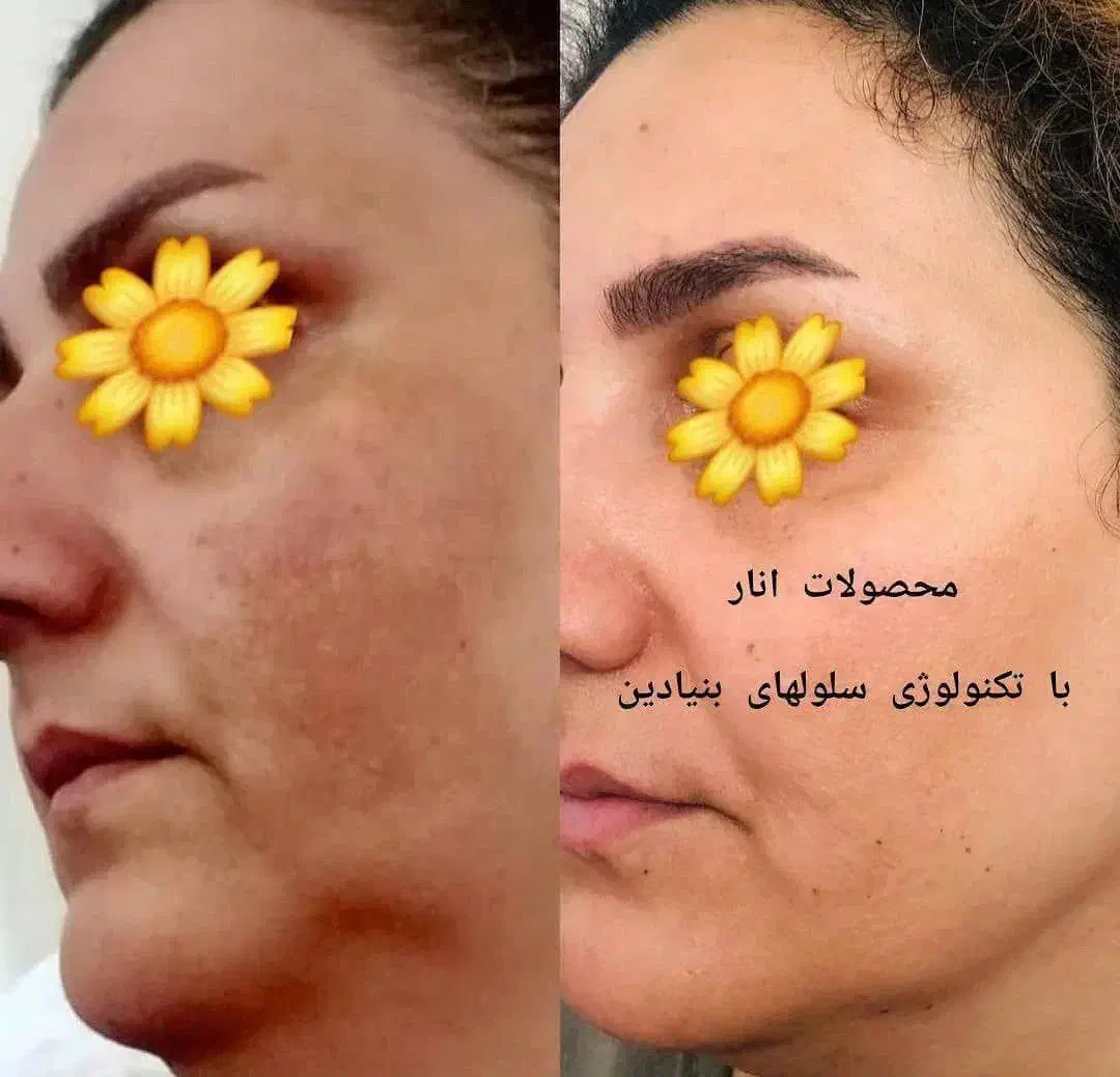 نماینده فروش محصولات پوست موزیبایی LEDORA|آرایشی، بهداشتی، درمانی|هشترود, |دیوار