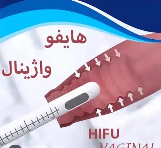 هایفو صورت|خدمات آرایشگری و زیبایی|کرج, گلشهر|دیوار