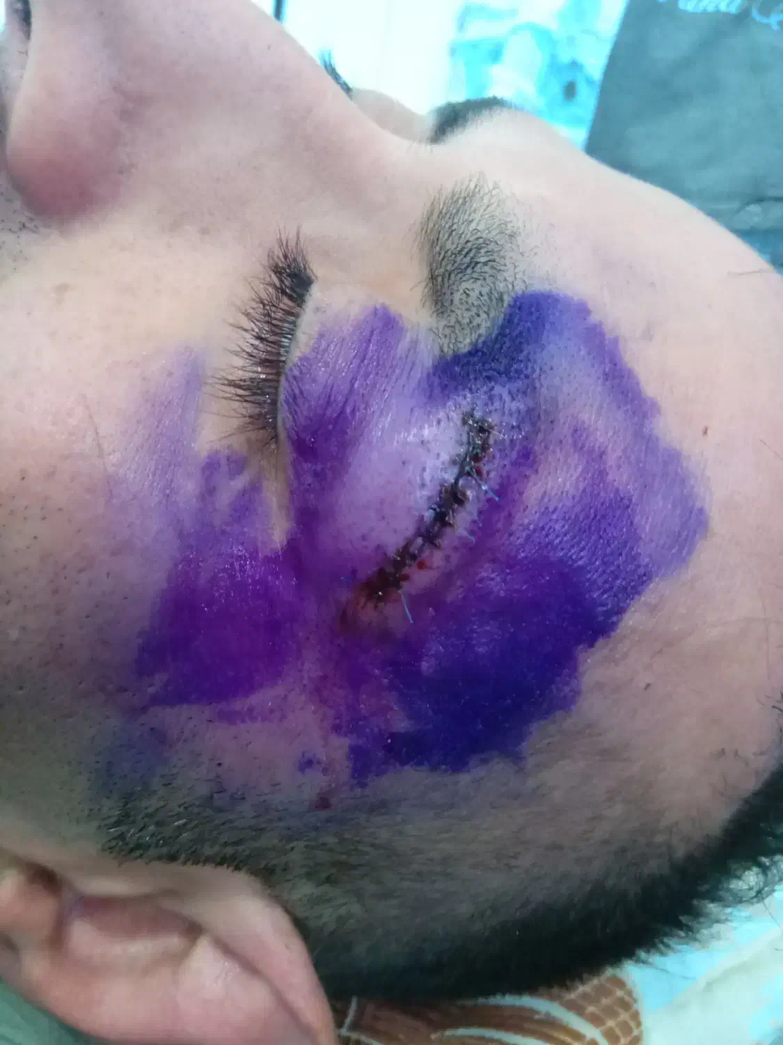 خدمات پرستاری در منزل.|خدمات آرایشگری و زیبایی|نجف‌آباد, هفده شهریور|دیوار