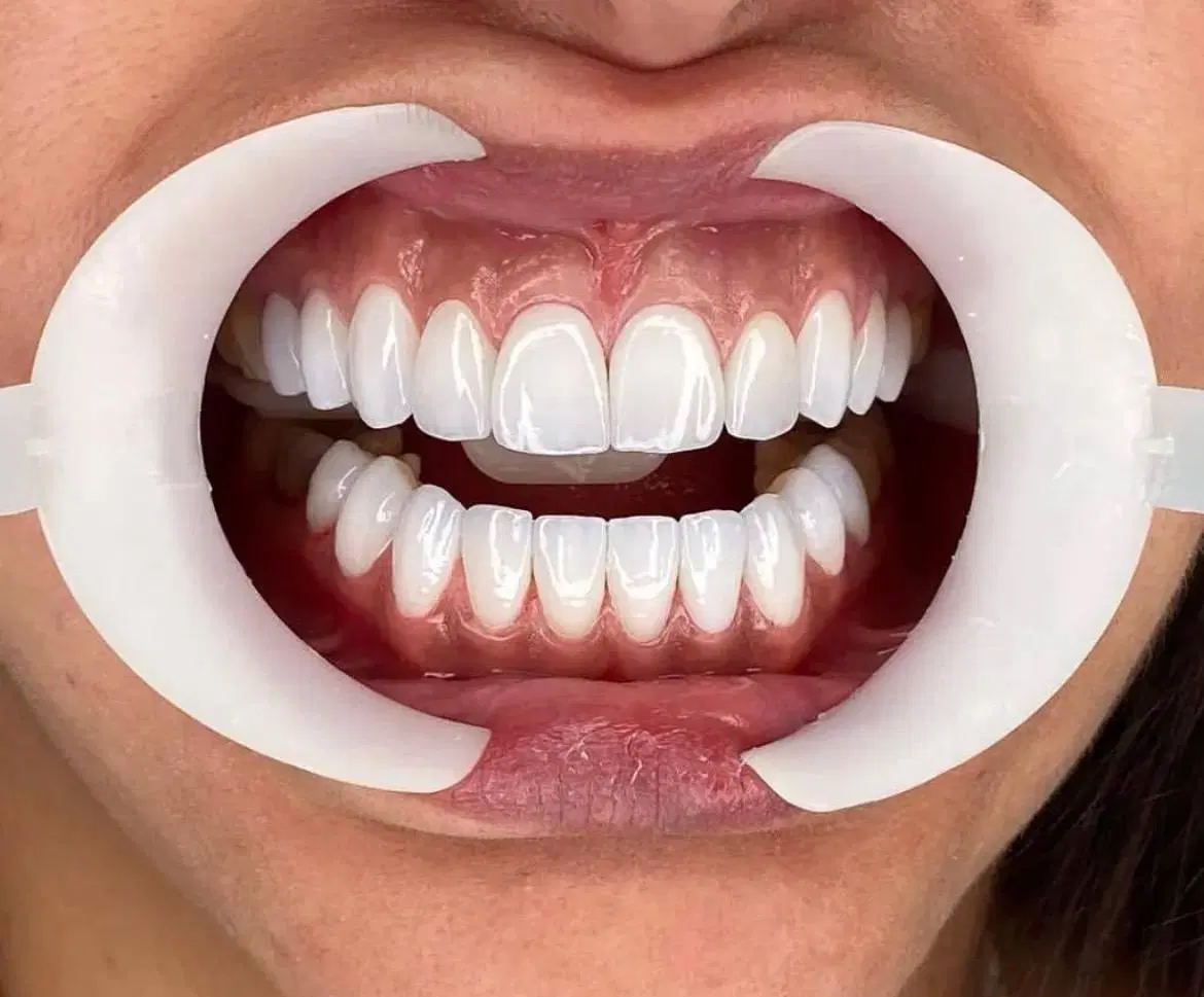 خدمات دندانپزشکی|خدمات زیبایی و سلامت|تهران, خواجه نظام الملک|دیوار