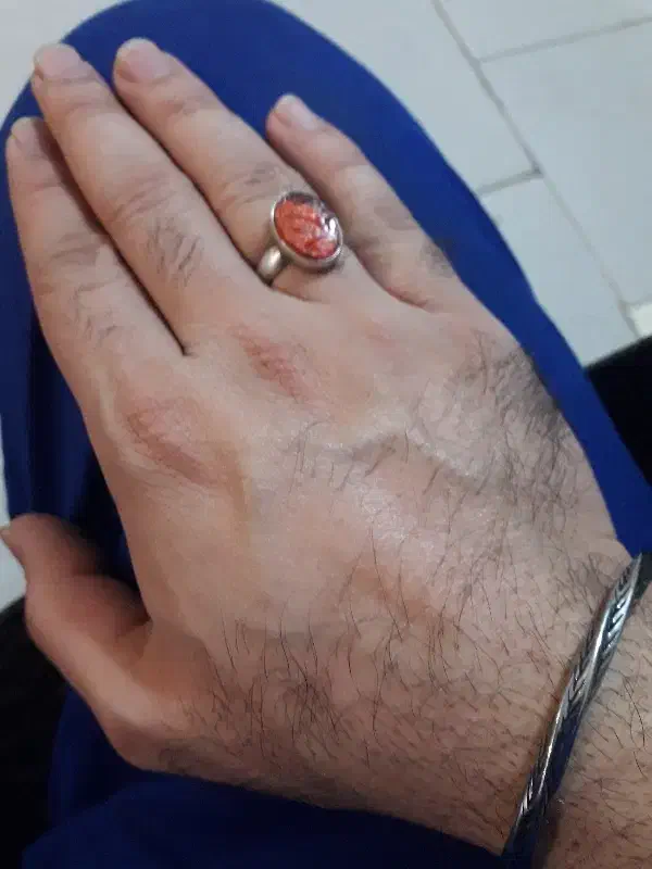 انگشتر|جواهرات|کرج, حسین آباد (اکبر آباد)|دیوار