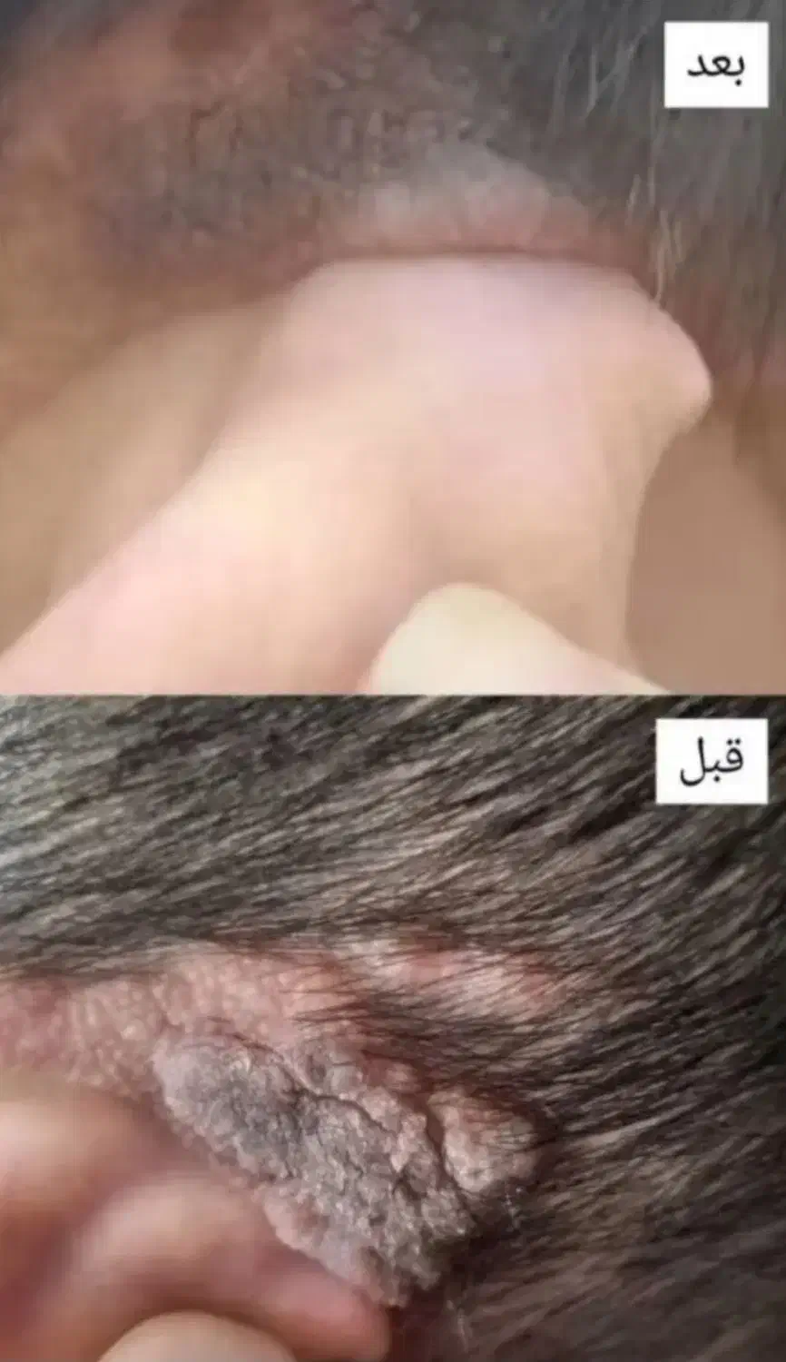 بهبودی ززگیل و تبخاال تظمینی|آرایشی، بهداشتی، درمانی|آبادان, |دیوار