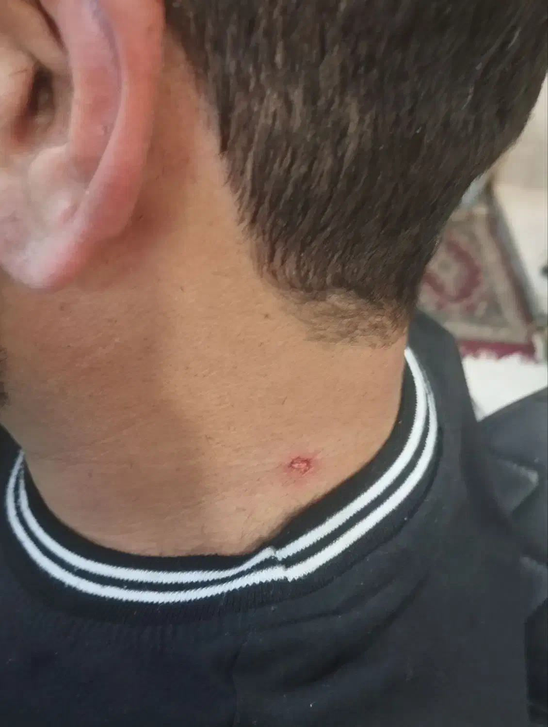 اصلاح خالبرداری لیزری پرسینگ گوش پاکسازی کامل پوست|خدمات آرایشگری و زیبایی|محمودآباد, |دیوار