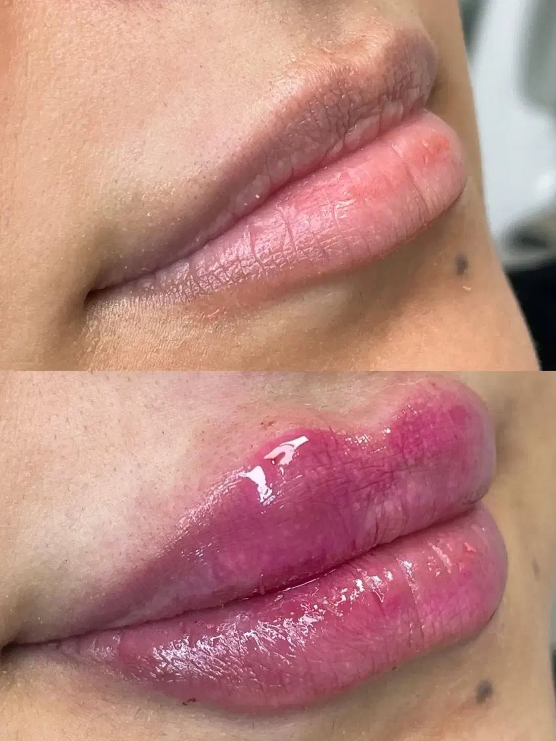 کلینیک زیبایی جراحی ژل بوتاکس غبغب فیلر لیزر مزو|خدمات آرایشگری و زیبایی|کرج, مهرویلا جنوبی|دیوار