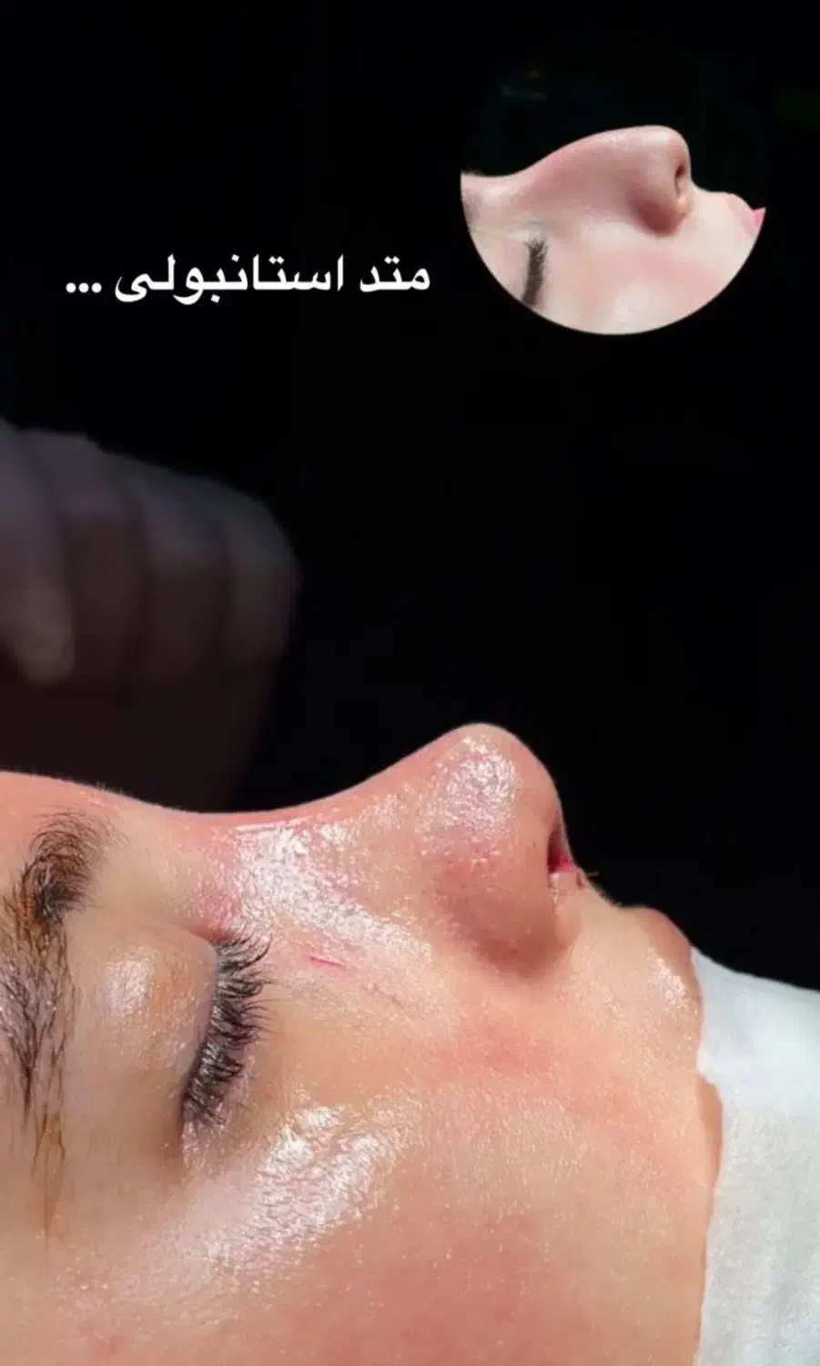 عمل بینی|خدمات آرایشگری و زیبایی|محمدشهر, محمدشهر|دیوار