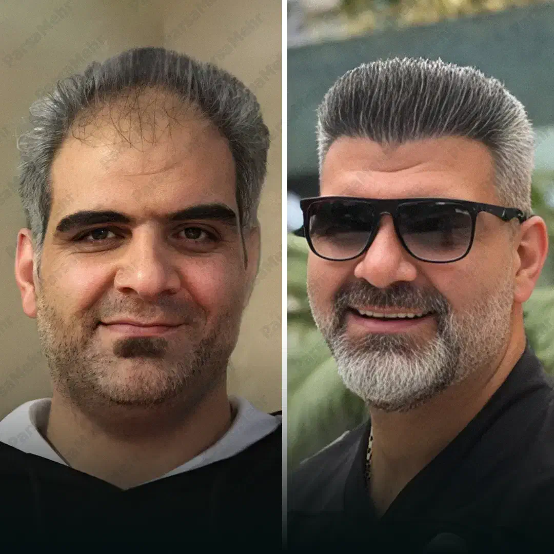 کلینیک VIP و تخصصی پوست، مو و زیبایی پارسامهر|خدمات آرایشگری و زیبایی|شیراز, عفیف‌آباد|دیوار