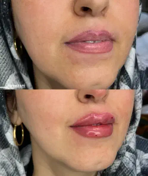 خدمات ژل و بوتاکس هر سی سی ژل ۴۸۰|خدمات آرایشگری و زیبایی|اهواز, حصیرآباد|دیوار