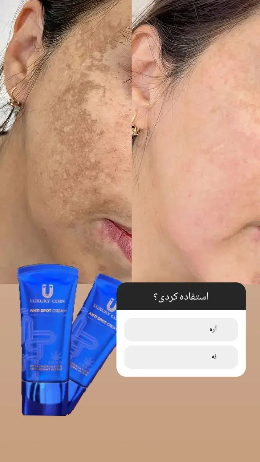 ضدلک اصل فرانسوی|حراج|قم, زنبیل آباد|دیوار