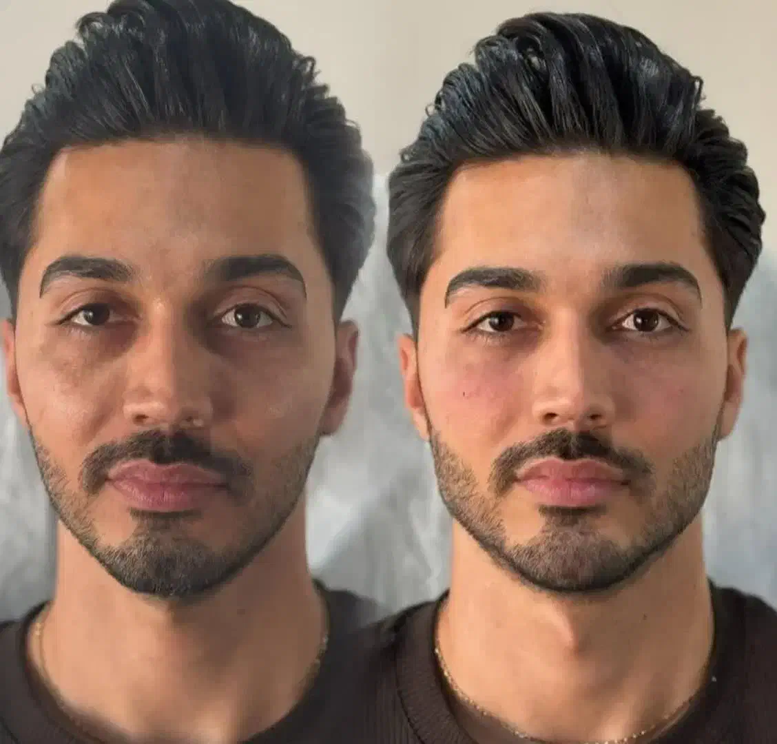 خدمات ژل بیکینی و زیر چشم و بوتاکس|خدمات آرایشگری و زیبایی|شاهین‌شهر, فردوسی|دیوار