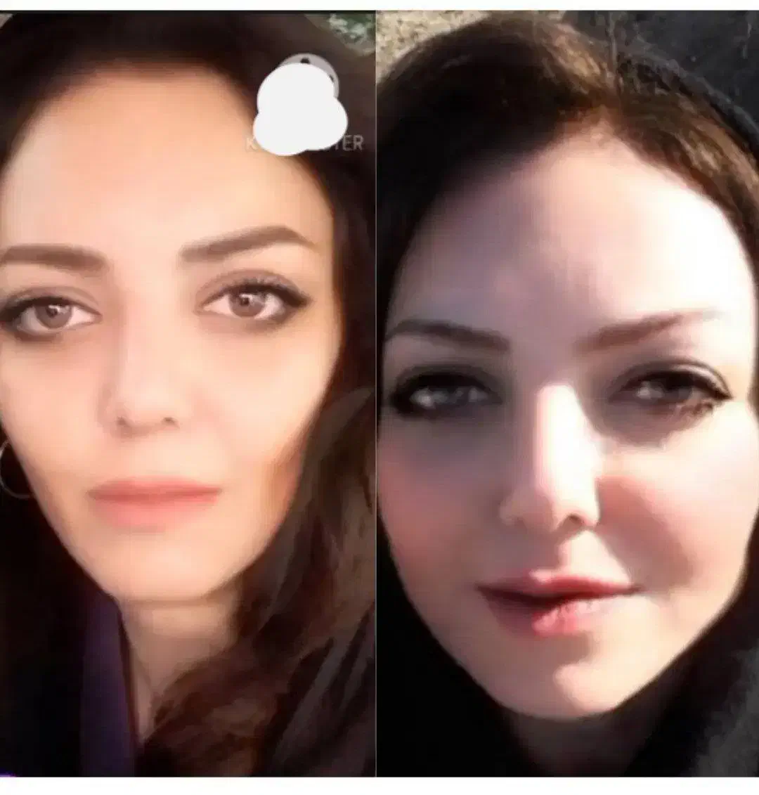 تپلی فوری صورت (چاقی صورت در ۱۰‌روز)|خوردنی و آشامیدنی|رشت, کاکتوس|دیوار