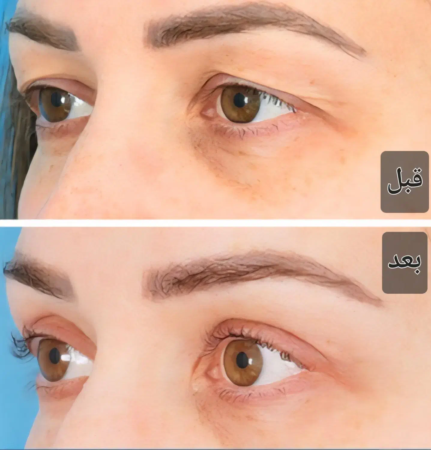 جشنواره تخفیف بلفاروپلاستی(جراحی پلک)|خدمات آرایشگری و زیبایی|شاهینشهر, فردوسی|دیوار