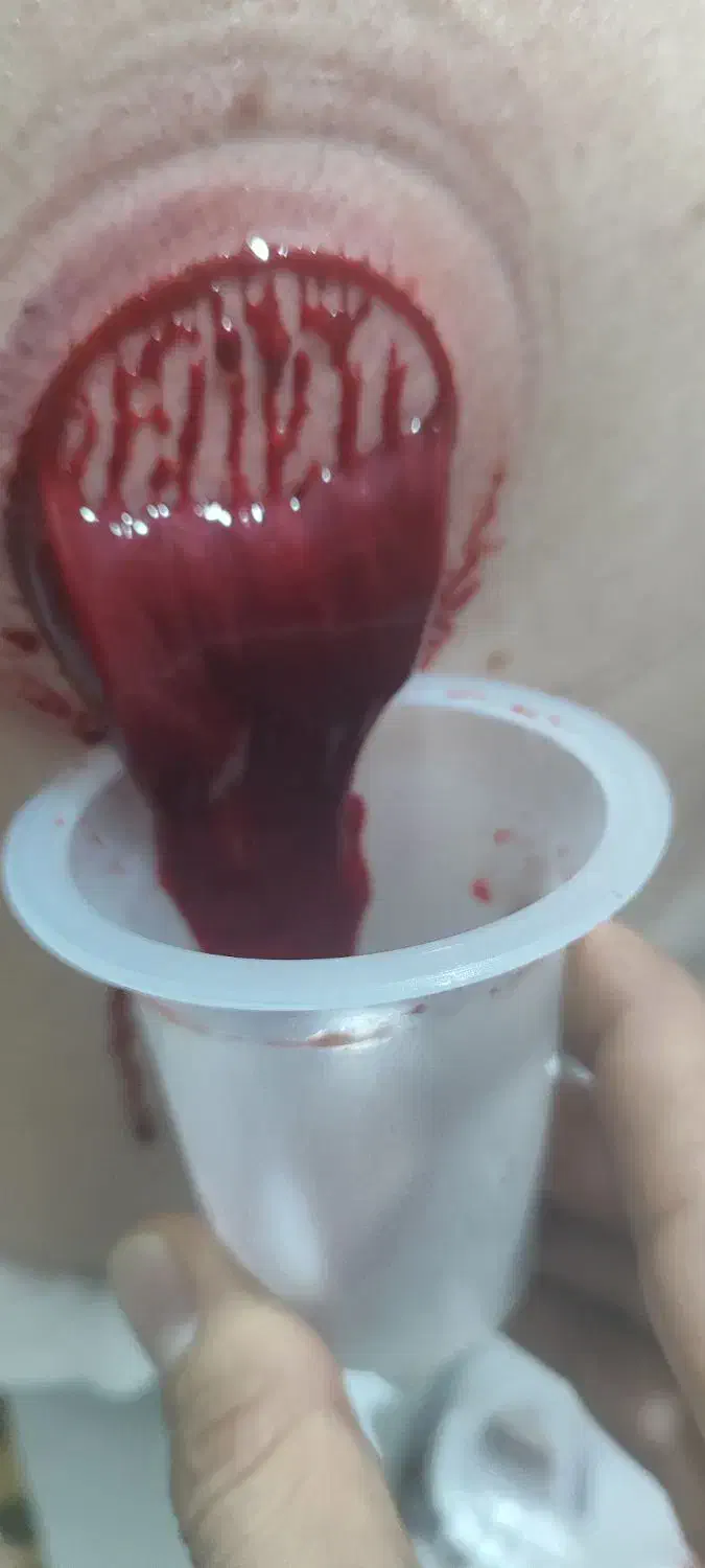 حجامت بادکش.طب سنتی برداشت خال وبا پزشک|خدمات آرایشگری و زیبایی|شیراز, دشت چنار|دیوار