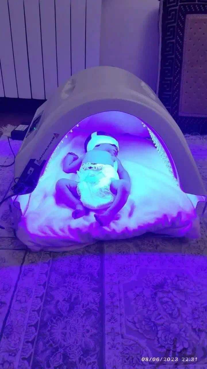 اجاره انواع دستگاه زردی نوزادان با تضمین درمان|خدمات آرایشگری و زیبایی|تبریز, |دیوار