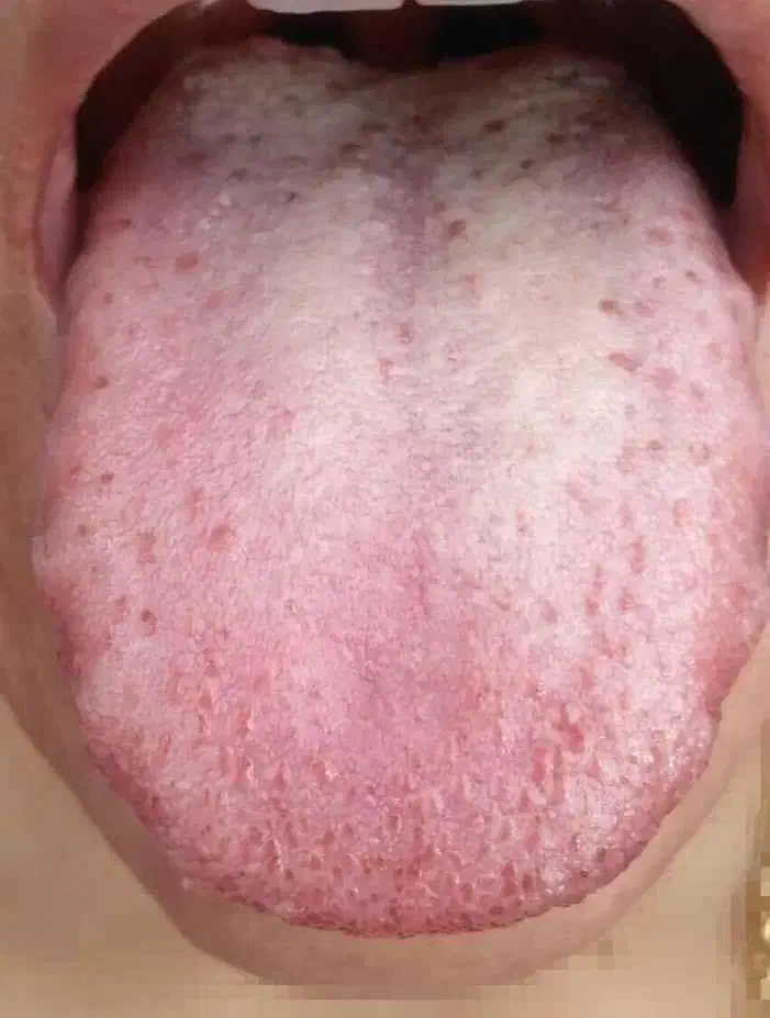 آشنایی با علم زبانشناسی و تشخیص بیماریها|خدمات آموزشی|زاهدان, |دیوار